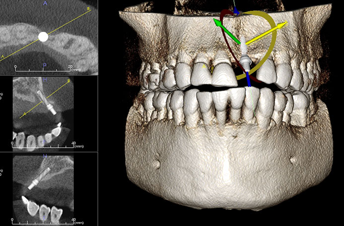  Digital Dentistry