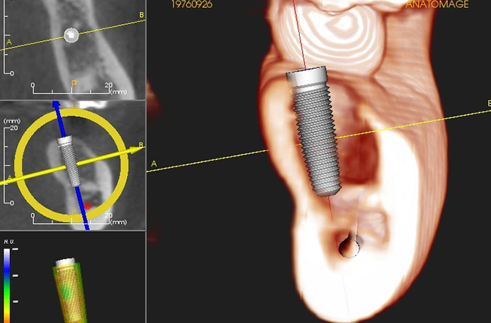  Digital Dentistry